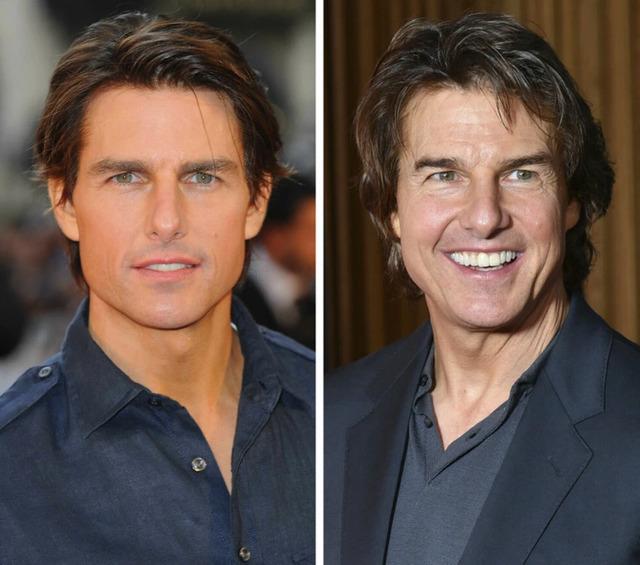 Tom Cruise’s Latest Look Sparks Debate: Has He Gone Too Far with Cosmetic Enhancements?